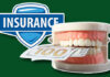 Does Insurance Cover Dental Sealants