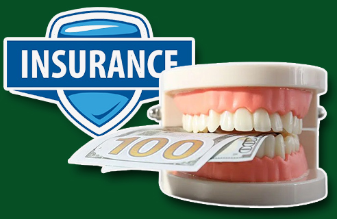 Does Insurance Cover Dental Sealants